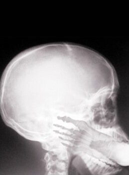 http://www.race-talk.org/wp-content/uploads/2010/01/foot_in_mouth_xray.jpg